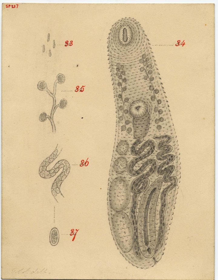 An example of a fully grown worm in an internal organ