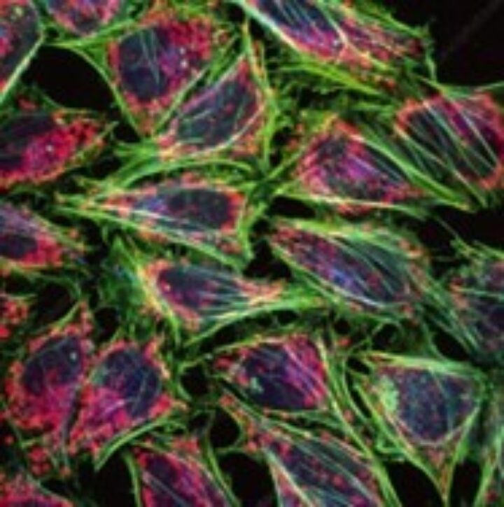 HeLa cells under a microscope, showing up as blue, pink and green cells.