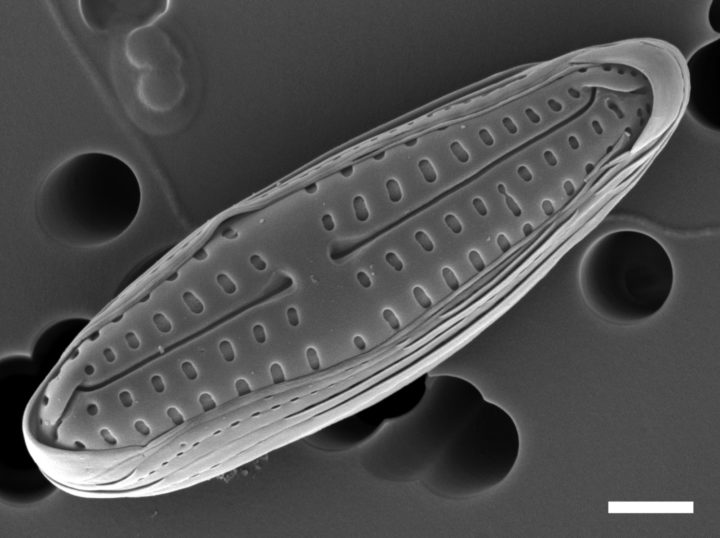 Scanning electron micrograph of diatom Poulinea lepidochelicola