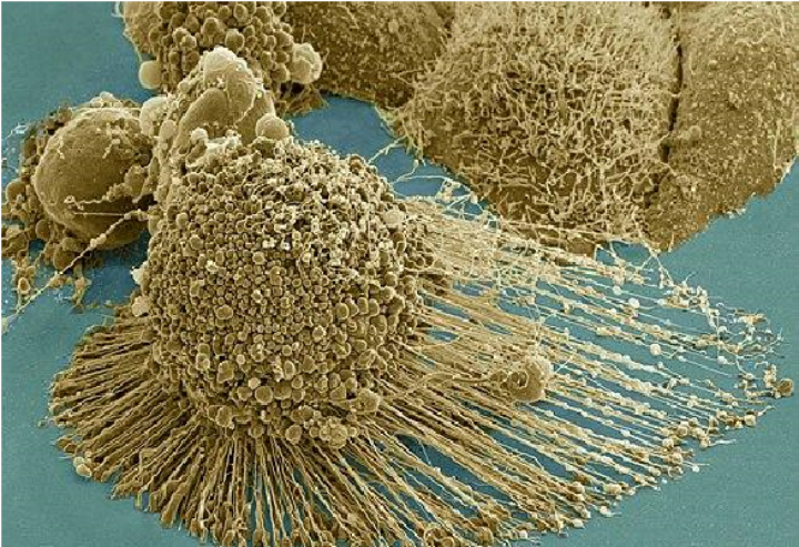 HeLa cells under a microscope, showing long yellow strands.