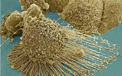 HeLa Cells: The Greatest Discovery of the 20th Century?